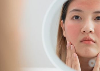 Sering Gonta-Ganti Skincare Karena FOMO, Tapi Kok Kulit Malah  Makin Sensitif?