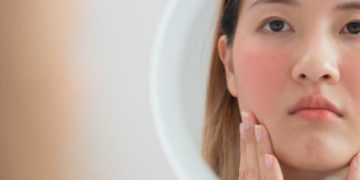 Sering Gonta-Ganti Skincare Karena FOMO, Tapi Kok Kulit Malah  Makin Sensitif?