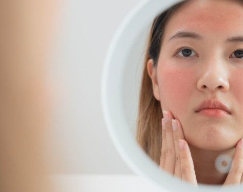 Sering Gonta-Ganti Skincare Karena FOMO, Tapi Kok Kulit Malah  Makin Sensitif?