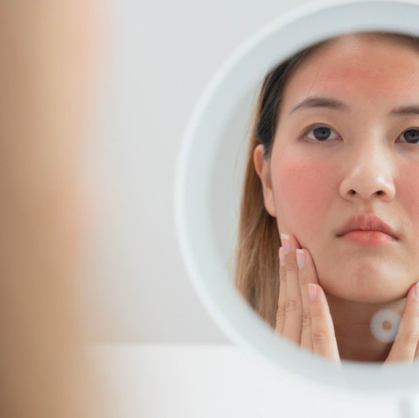 Sering Gonta-Ganti Skincare Karena FOMO, Tapi Kok Kulit Malah Makin Sensitif?