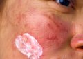 Udah Tahu Sunscreen Penting, Tapi Kulit Sensitif Sering Bikin Kamu Ragu Memakainya? Ketahui Hal Ini!