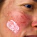 Udah Tahu Sunscreen Penting, Tapi Kulit Sensitif Sering Bikin Kamu Ragu Memakainya? Ketahui Hal Ini!
