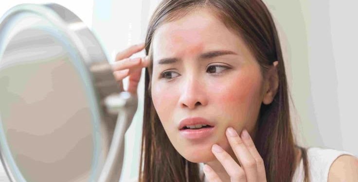 Polusi Udara Bisa Memengaruhi Kulit? Kenali Dampaknya!